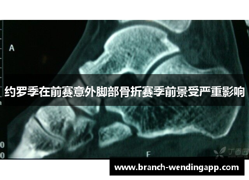 约罗季在前赛意外脚部骨折赛季前景受严重影响